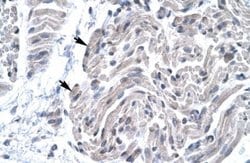 FOXE3 Rabbit anti-Human, Polyclonal, Novus Biologicals:Antibodies:Primary